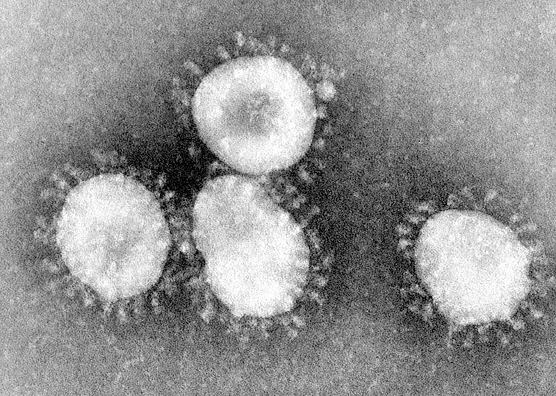 Coronaviruses