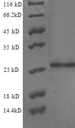 Endothelial protein C receptor (PROCR), partial, human, recombinant