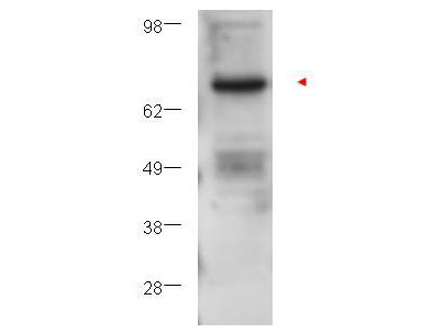 Anti-Protein Kinase C beta (PKC beta)