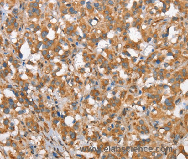 Anti-CSMD1