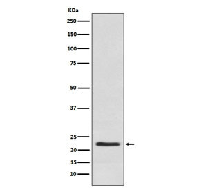 Anti-CSH1 / Placental Lactogen, clone AFGE-3