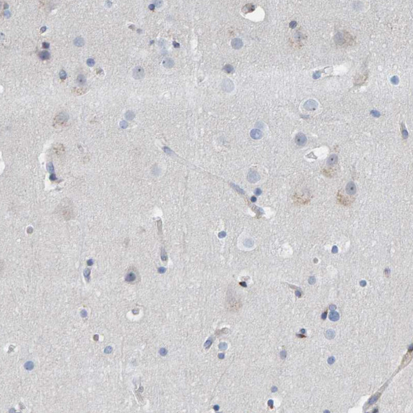 Anti-MMP16