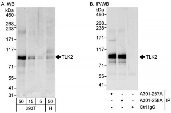 Anti-TLK2