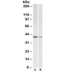 Anti-TNNT2