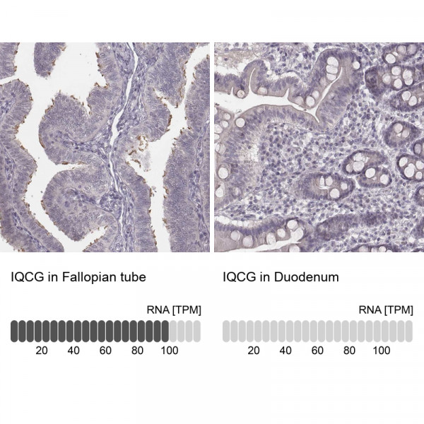 Anti-IQCG