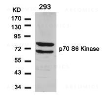 Anti-p70 S6 Kinase (Ab-411)