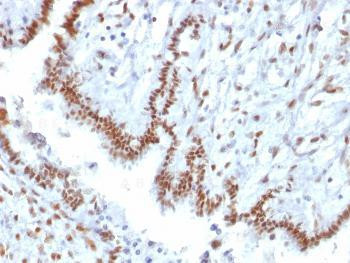 Anti-TLE1 (Synovial Sarcoma Marker) Monoclonal Antibody (Clone: TLE1/2085)