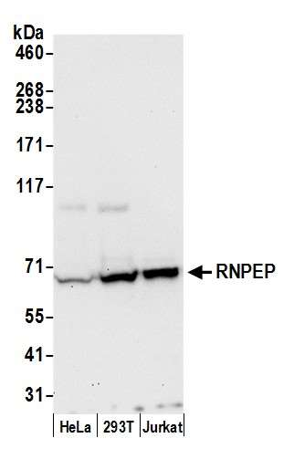 Anti-RNPEP