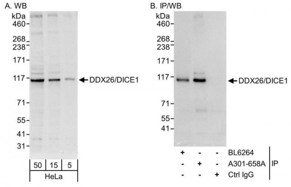 Anti-DDX26/DICE1