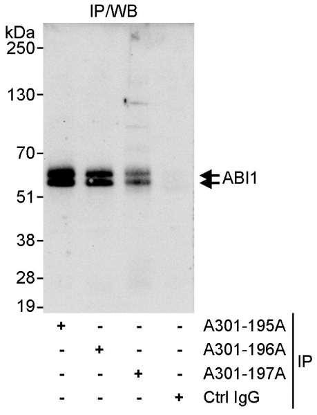 Anti-ABI1