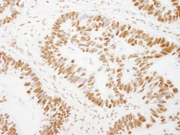 Anti-GTF2I/TFII-I (IHC)
