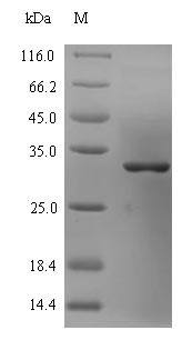 Large cysteine-rich periplasmic protein OmcB (omcB), partial, Chlamydia pneumoniae, recombinant