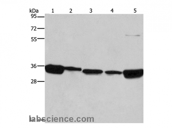 Anti-ELAVL1
