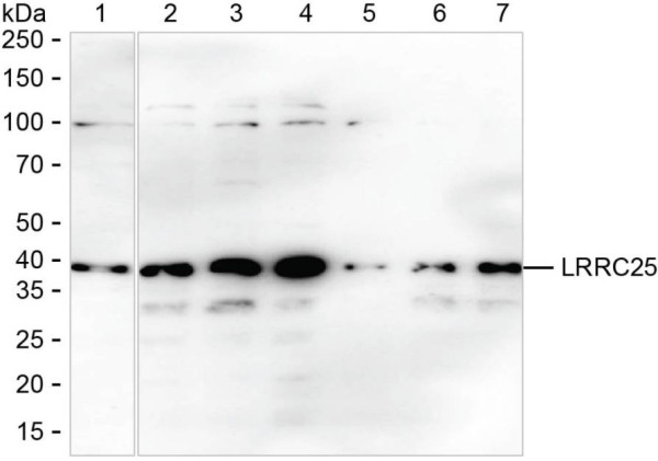 Anti-LRRC25