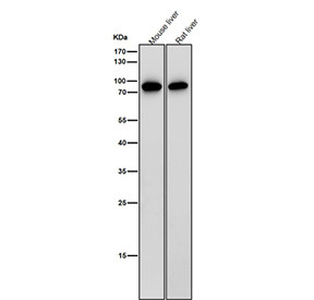 Anti-IL12B / Interleukin 12 beta / IL12 p40, clone 31I13