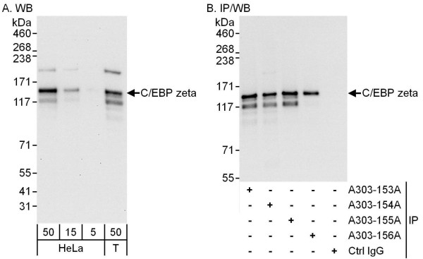 Anti-C/EBP zeta