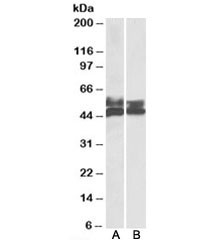 Anti-FCRL1