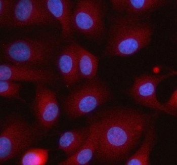 Anti-ITPRIPL1 / Inositol 1, 4, 5-trisphosphate receptor-interacting protein-like 1