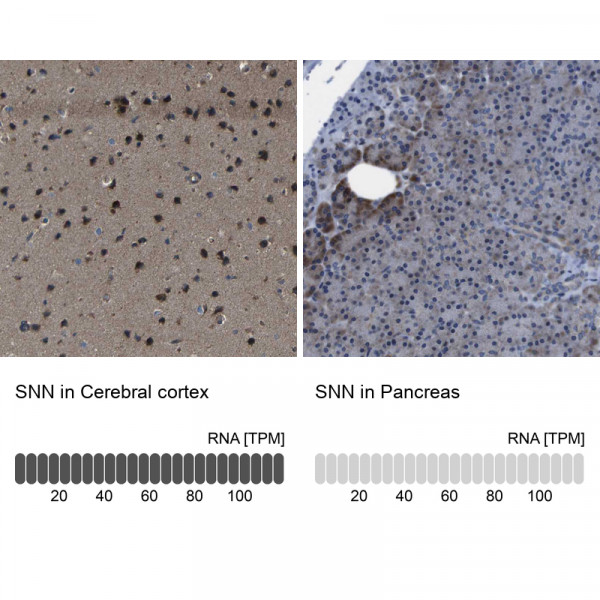 Anti-SNN