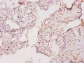 Anti-Csf1