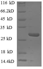 Nuclear pore complex protein Nup153 (NUP153), partial, human, recombinant