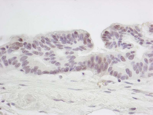 Anti-SMC6 (IHC)
