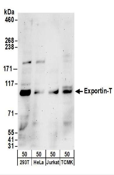 Anti-Exportin-T