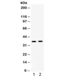 Anti-FosB