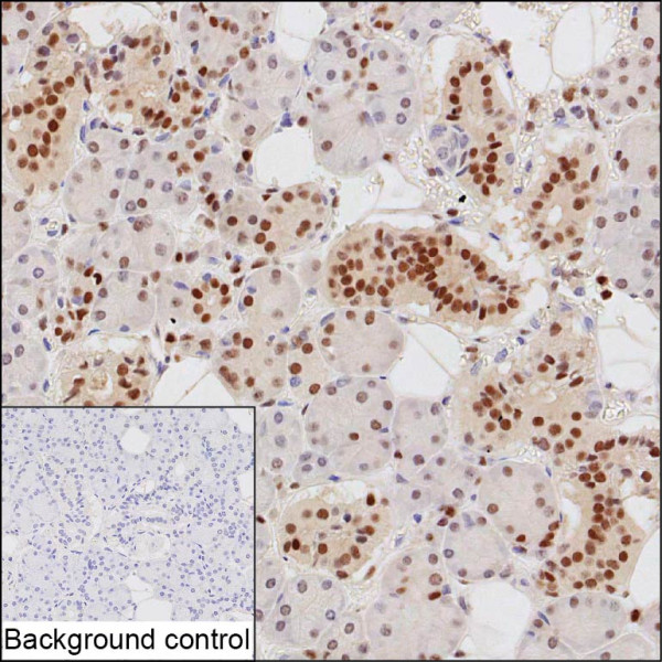 Anti-RUNX2 Recombinant