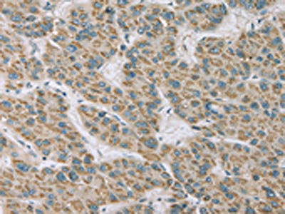 Anti-RNASE3