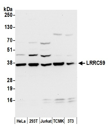 Anti-LRRC59