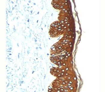 Anti-Basic Cytokeratin, clone AE3