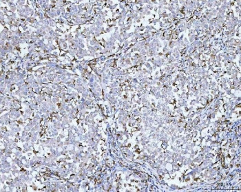 Anti-CD14