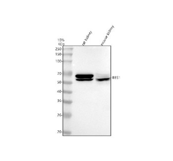 Anti-BBS1 / Bardet-Biedl syndrome 1