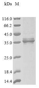Erythropoietin receptor (EPOR), partial, dog, recombinant