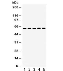 Anti-Monoamine Oxidase A / MAOA