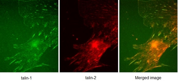 Anti-TLN1 / Talin 1, clone 97H6