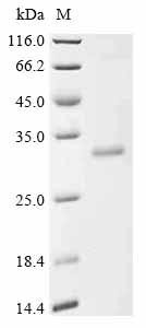 Dipeptidyl peptidase 9 (DPP9), partial, human, recombinant