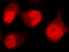 Anti-DNA-PKcs, clone 8D3-B12-F11