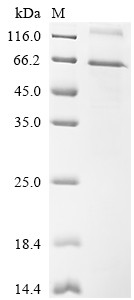 Netrin-G1 (Ntng1), mouse, recombinant