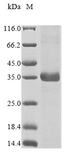 Ketohexokinase (Khk), mouse, recombinant