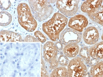 Anti-KChIP2 / KCNIP2, clone KCNIP2/7588