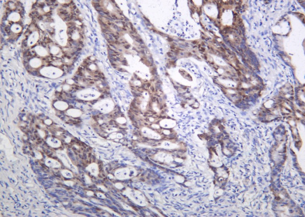 Anti-Recombinant CDX2, clone 2D6