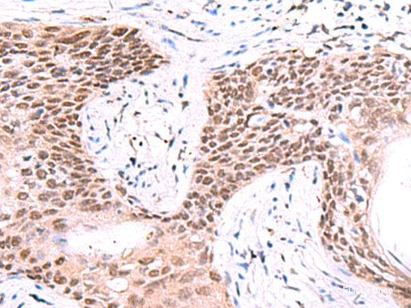 Anti-IRF2BP1