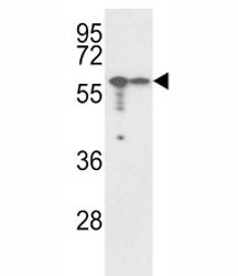 Anti-Vimentin