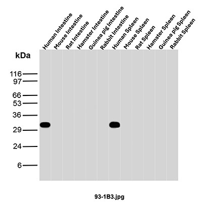 Anti-CD20 / MS4A1 (B-Cell Marker), clone 93-1B3