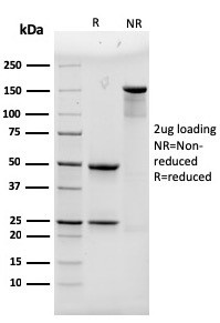 Anti-Alpha Actinin 4 / ACTN4, clone 93