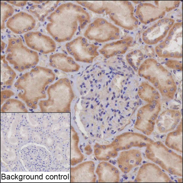 Anti-RNF31