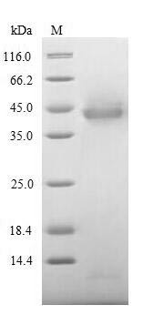 Inter-alpha-trypsin inhibitor heavy chain H4 (ITIH4), partial, human, recombinant