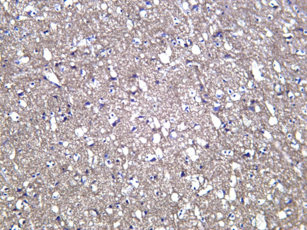 Anti-Recombinant CD200, clone C312504